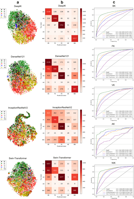 Deep learning for multi-type infectious keratitis diagnosis: A nationwide, cross-sectional, multicenter study