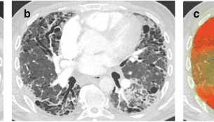 Orchestrating explainable artificial intelligence for multimodal and longitudinal data in medical imaging