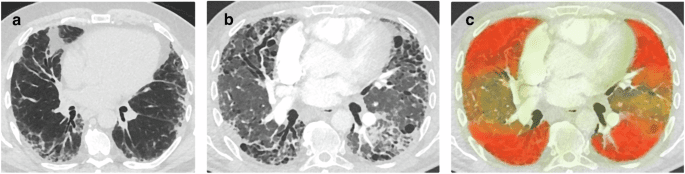 Orchestrating explainable artificial intelligence for multimodal and longitudinal data in medical imaging