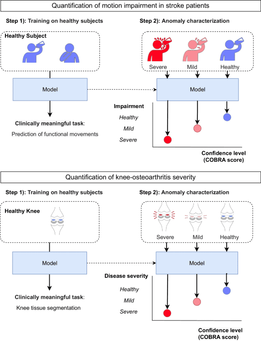 Quantifying impairment and disease severity using AI models trained on healthy subjects