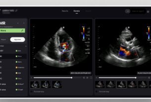 AISAP's AI-Powered Cardiac Ultrasound Receives FDA Clearance