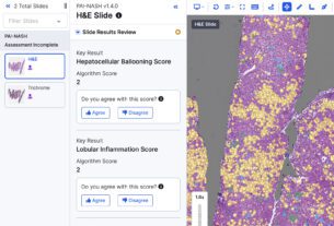PathAI Introduces AI-Based Measurement for MASH Scoring
