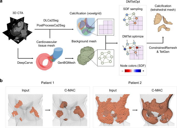 Robust automated calcification meshing for personalized cardiovascular biomechanics