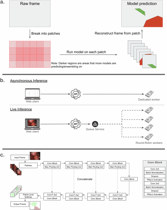 Development, deployment and scaling of operating room-ready artificial intelligence for real-time surgical decision support