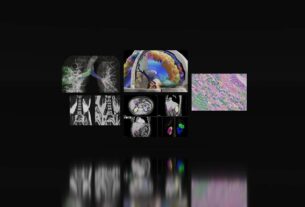Medical Experts Utilize NVIDIA-Powered Federated Learning to Advance AI in Tumor Segmentation