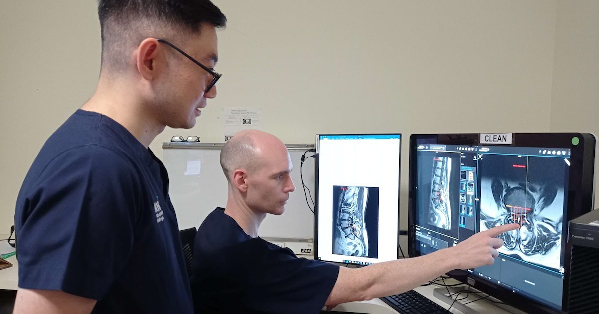 NUH AI interprets spinal stenosis in '47 seconds' and more AI briefs