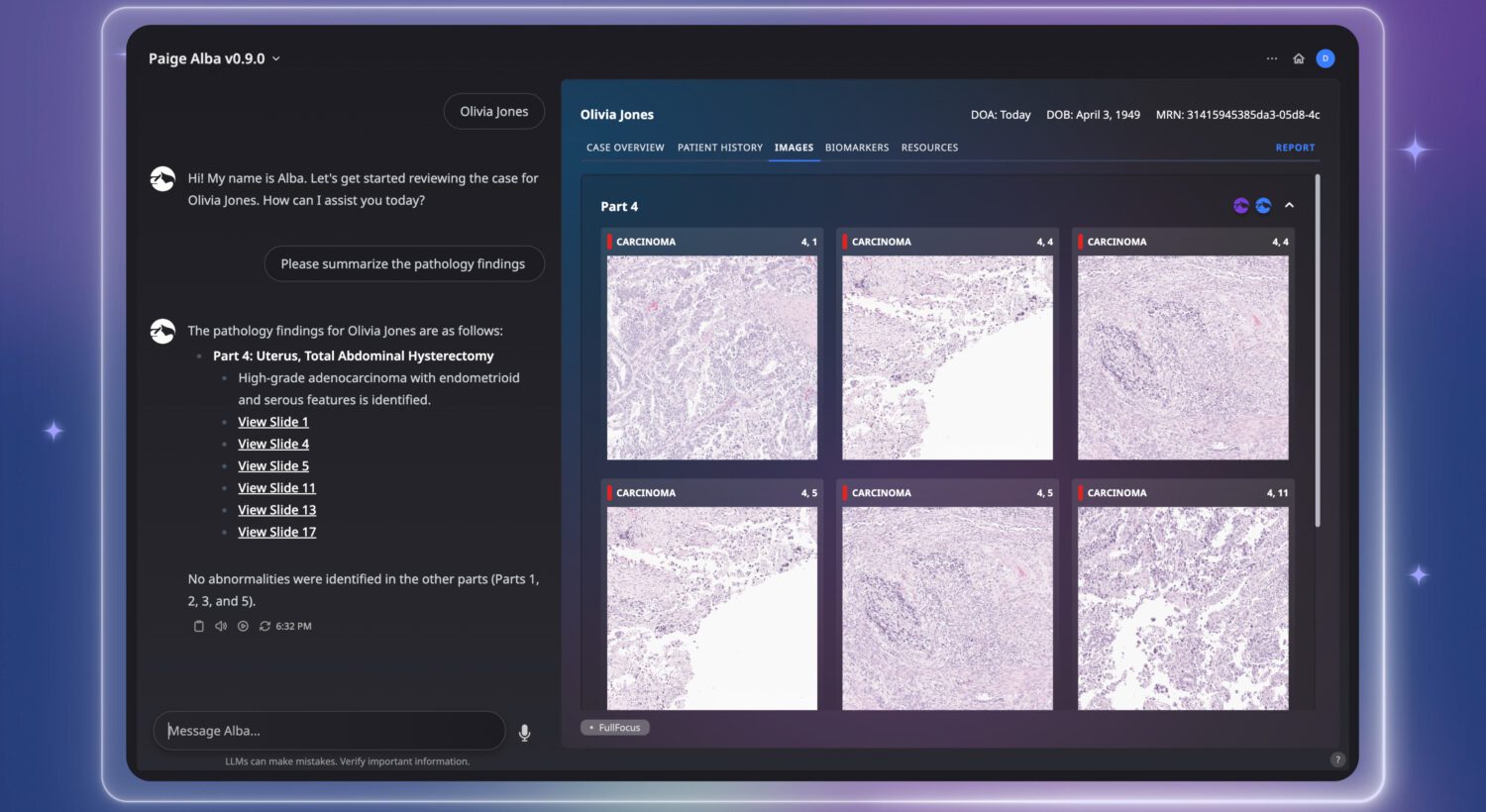 Paige Unveils AI Co-Pilot for Pathology & Oncology, Paige Alba