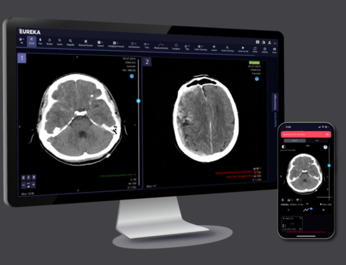 ConcertAI’s TeraRecon Streamlines Cardiac MR Workflows with Intuition 4.10