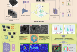 Early detection of dementia through retinal imaging and trustworthy AI