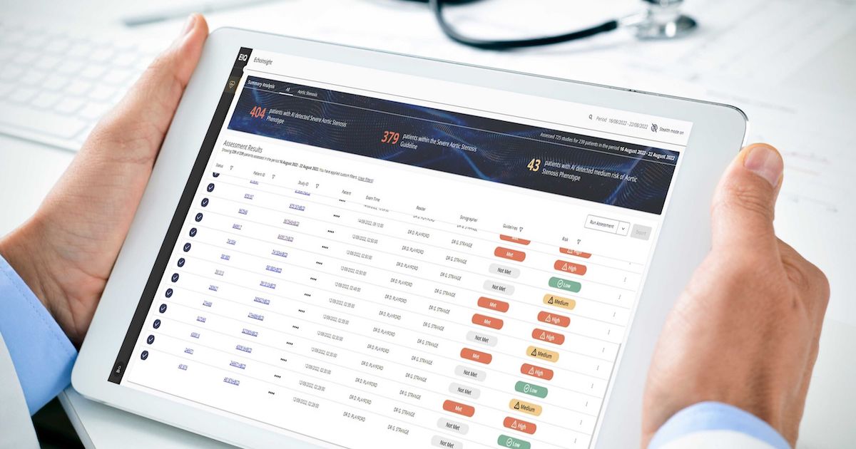 Echo IQ bags 510(k) for heart disease AI