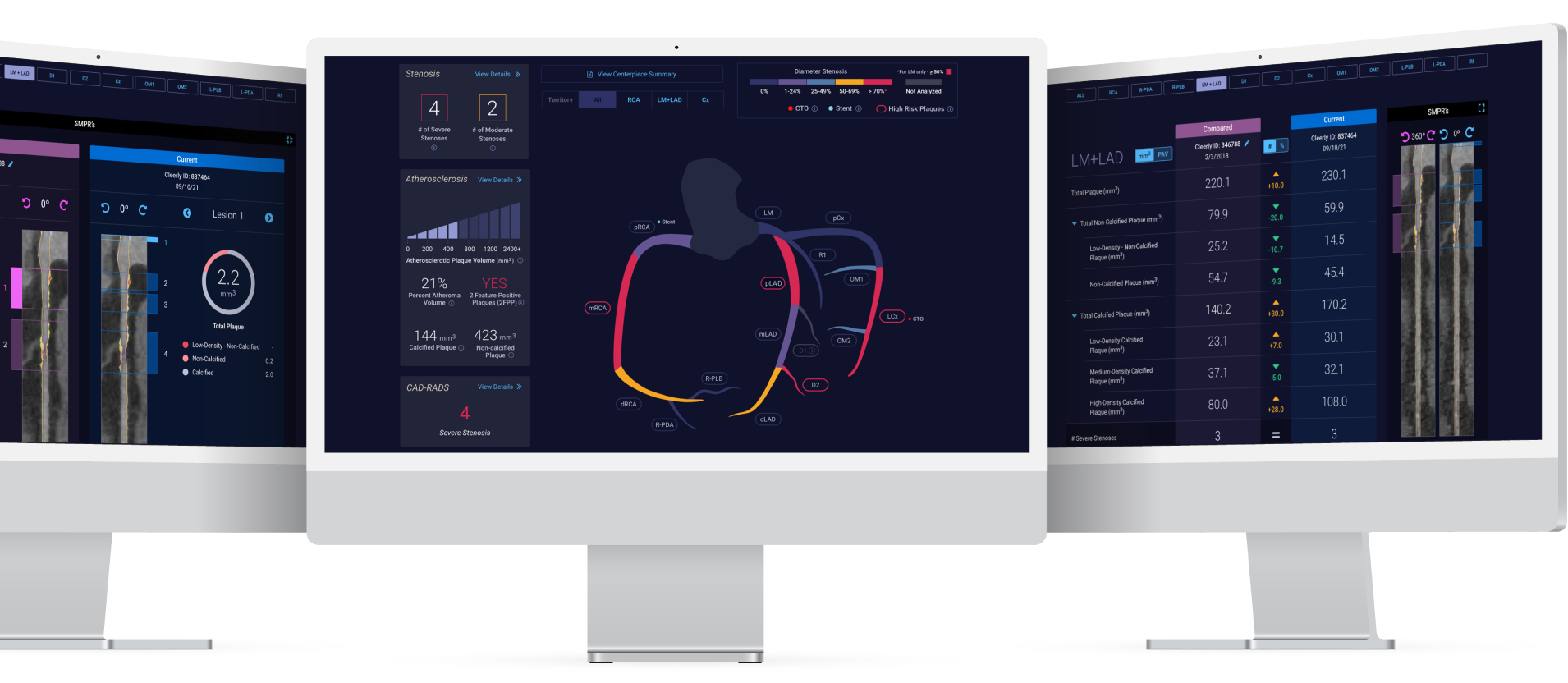 Medicare Approves Cleerly's AI-Powered Heart Scan