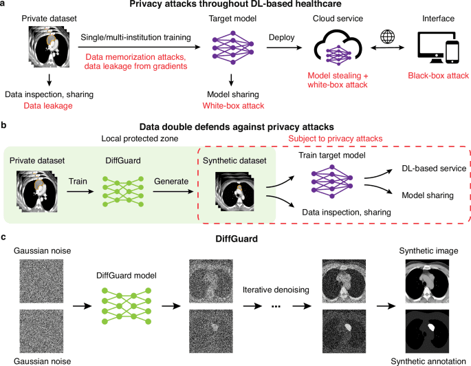 Privacy enhancing and generalizable deep learning with synthetic data for mediastinal neoplasm diagnosis