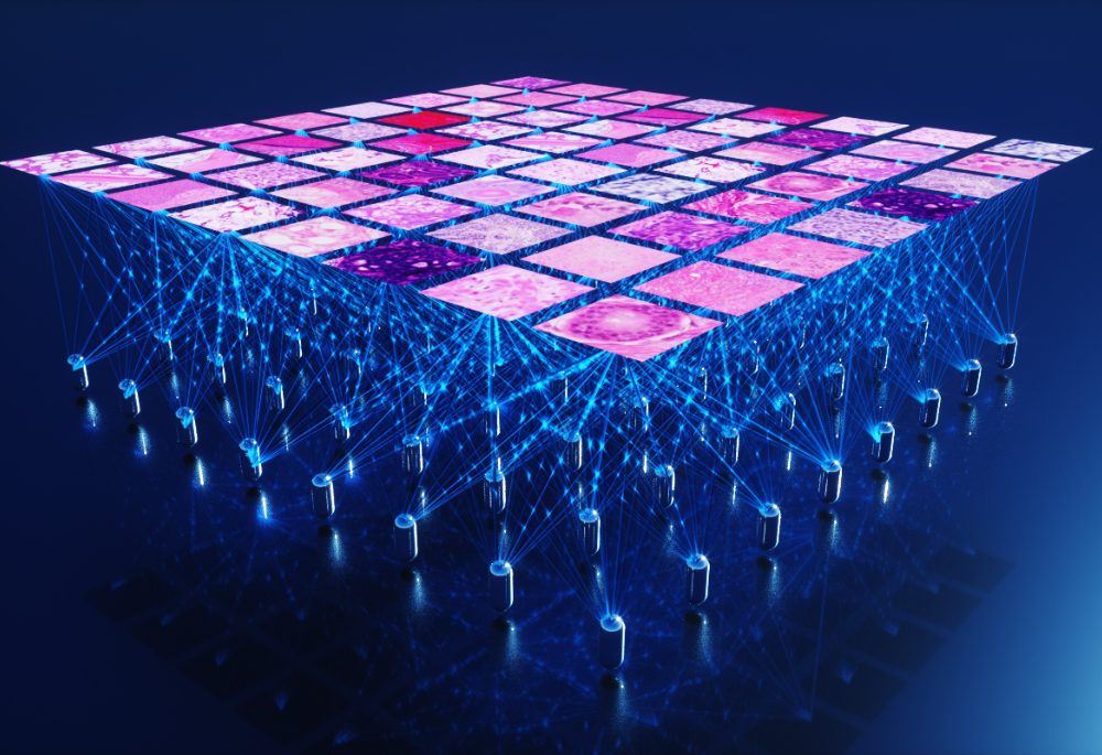 Proscia Launches Concentriq Embeddings and AI Toolkit