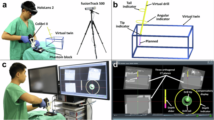 Accuracy and efficiency of drilling trajectories with augmented reality versus conventional navigation randomized crossover trial