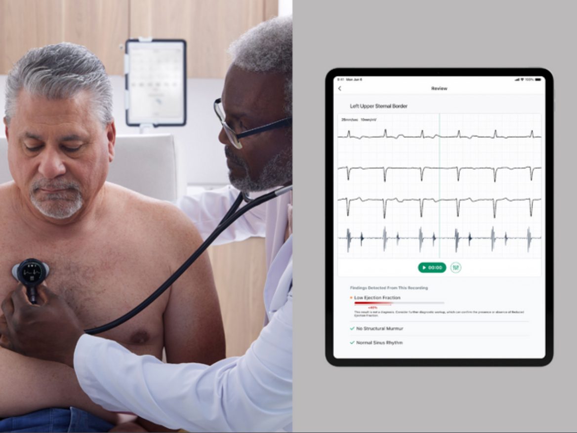 AMA Issues CPT Code for Eko Health’s AI-Powered Cardiac Screening Tool