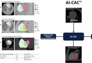 Artificial intelligence applied to coronary artery calcium scans (AI-CAC) significantly improves cardiovascular events prediction