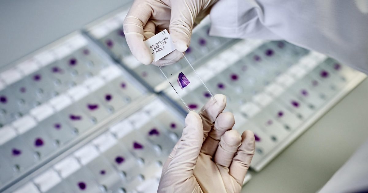 Lunit, AstraZeneca to develop AI-based digital pathology and more briefs