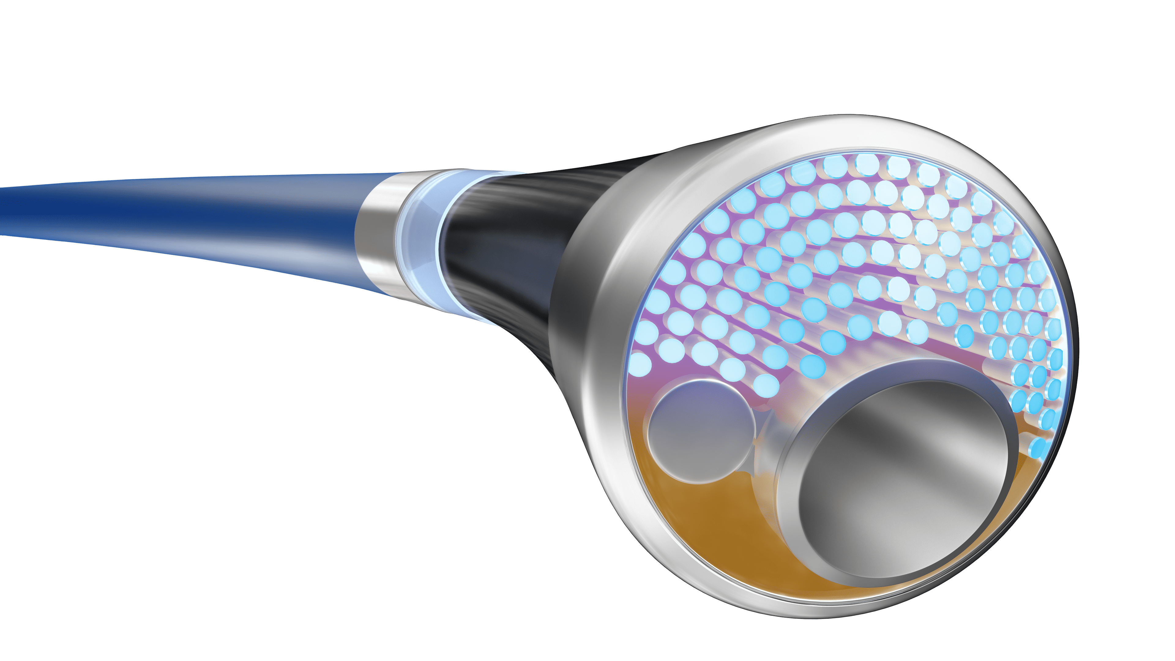 Philips Launches THOR IDE Clinical Trial for Innovative PAD Treatment Device