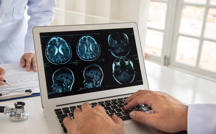 All 107 stroke centres in England using AI technology, says NHSE