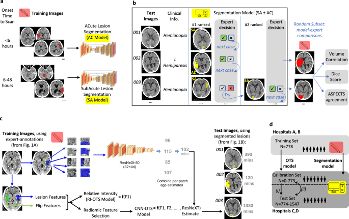 Deep learning biomarker of chronometric and biological ischemic stroke lesion age from unenhanced CT