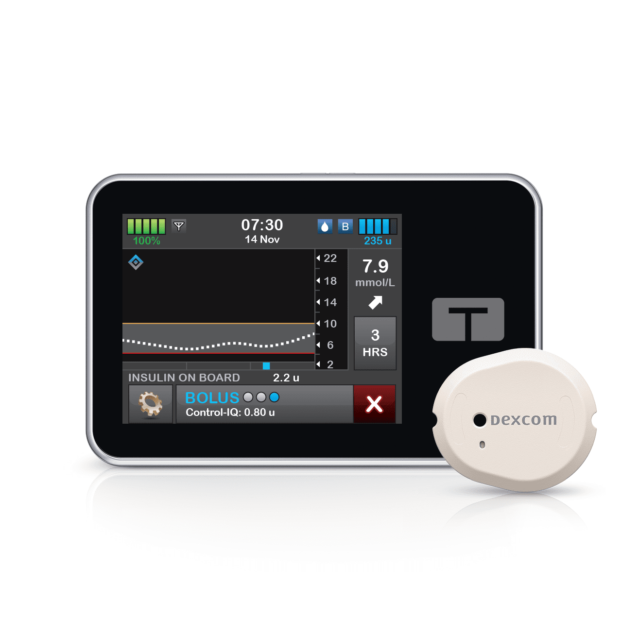Tandem t:slim X2 Pump Now Compatible with Dexcom G7 in Canada