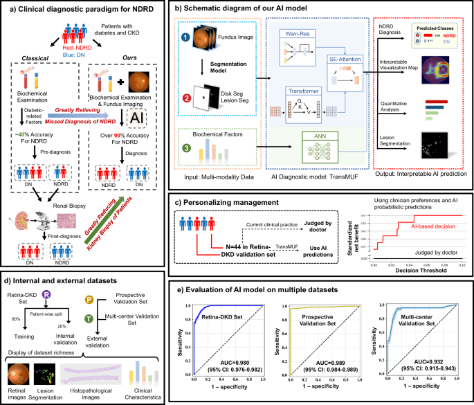 A multimodal transformer system for noninvasive diabetic nephropathy diagnosis via retinal imaging