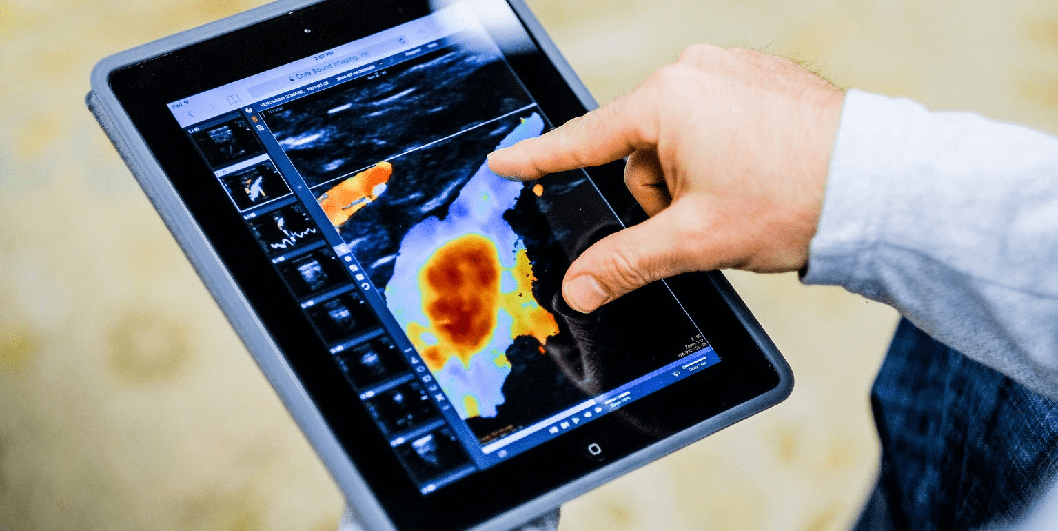 Core Sound Imaging Secures $80M for Medical Imaging Platform