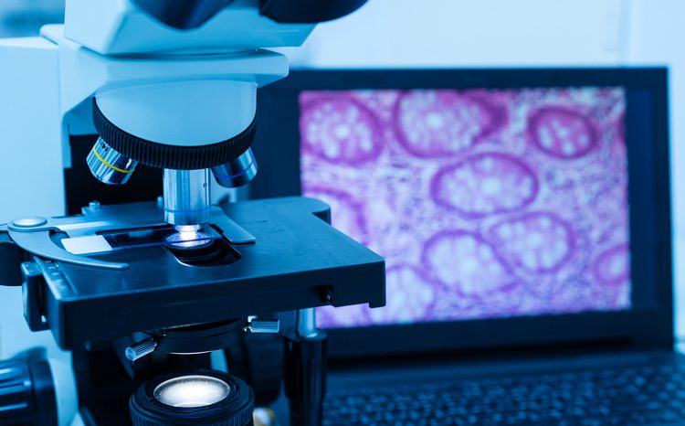 Deciphex raises £26m to expand pathology access