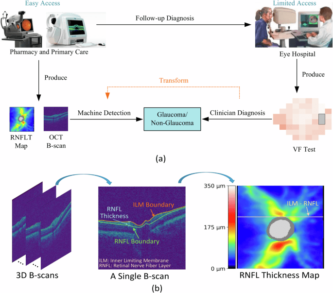 Equitable artificial intelligence for glaucoma screening with fair identity normalization