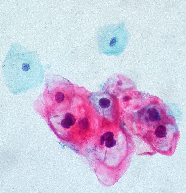 Meet the Company Developing an At-Home Test to Replace the Pap Smear - MedCity News