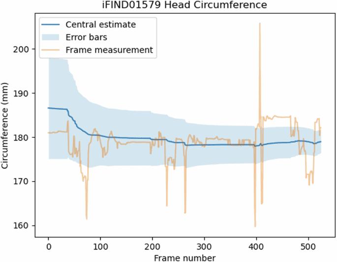 Whole examination AI estimation of fetal biometrics from 20-week ultrasound scans