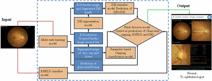 A hybrid multi model artificial intelligence approach for glaucoma screening using fundus images