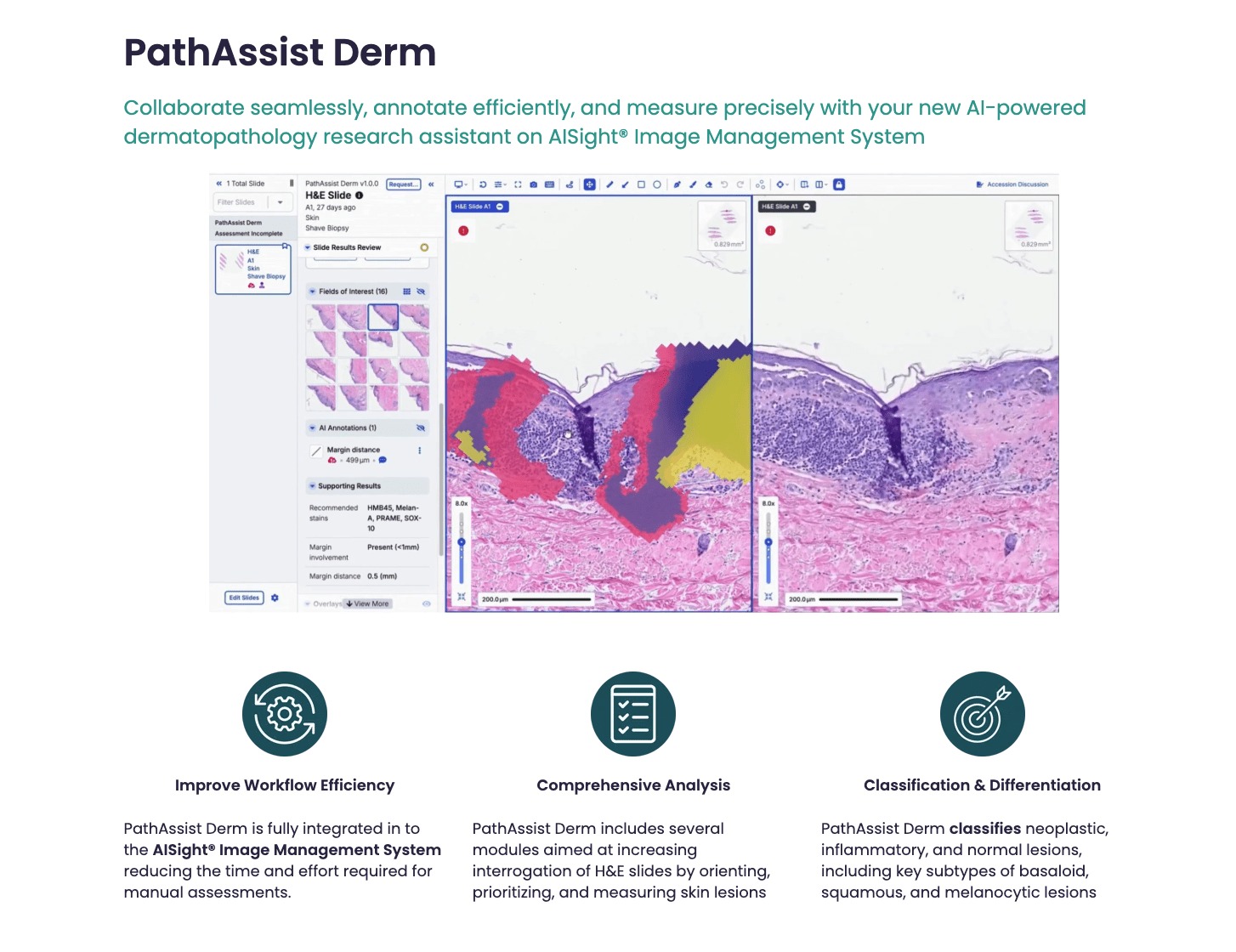 PathAI Launches PathAssist Derm, an AI-Powered Tool for Skin Lesion Analysis
