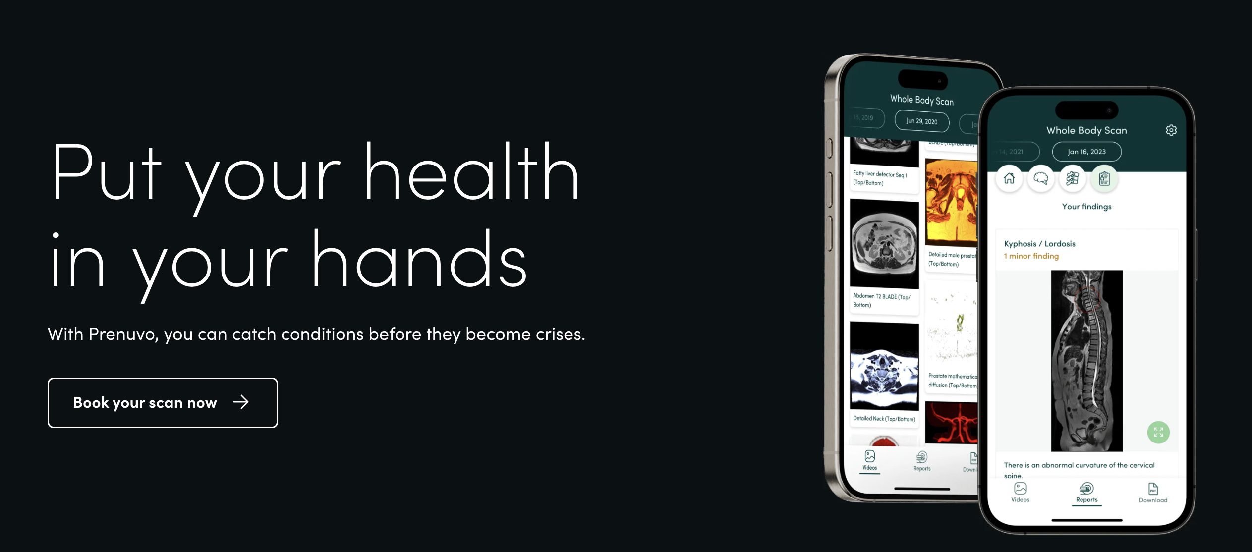 Prenuvo Raises $120M to Expand Whole-Body MRI Screening