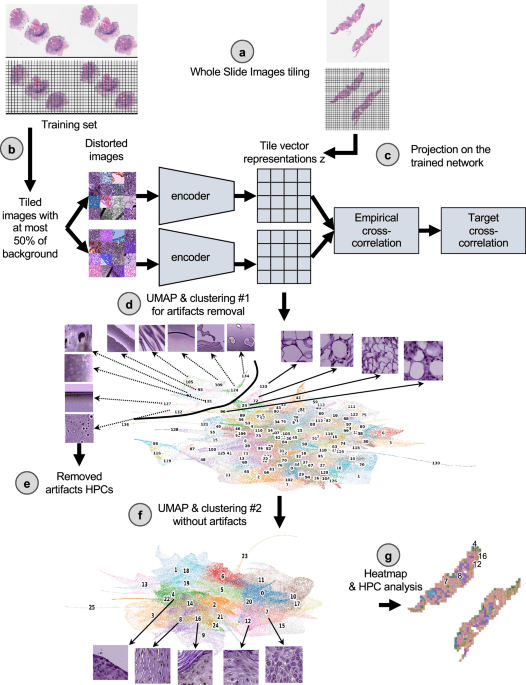 Self supervised artificial intelligence predicts poor outcome from primary cutaneous squamous cell carcinoma at diagnosis