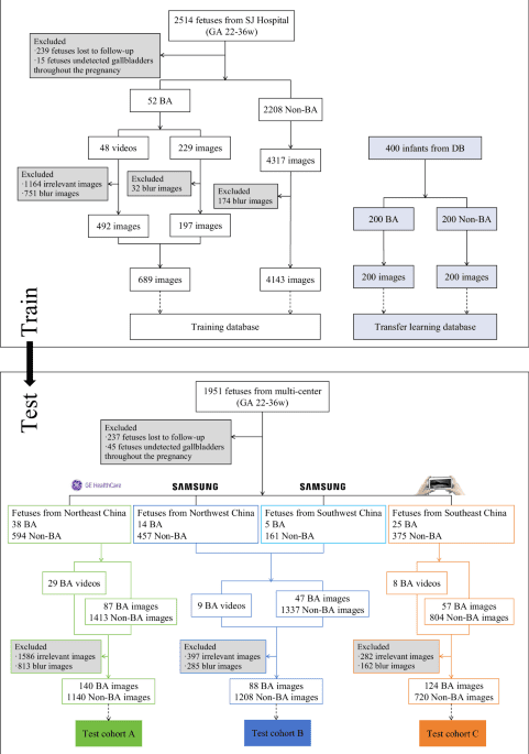 Transfer learning method for prenatal ultrasound diagnosis of biliary atresia
