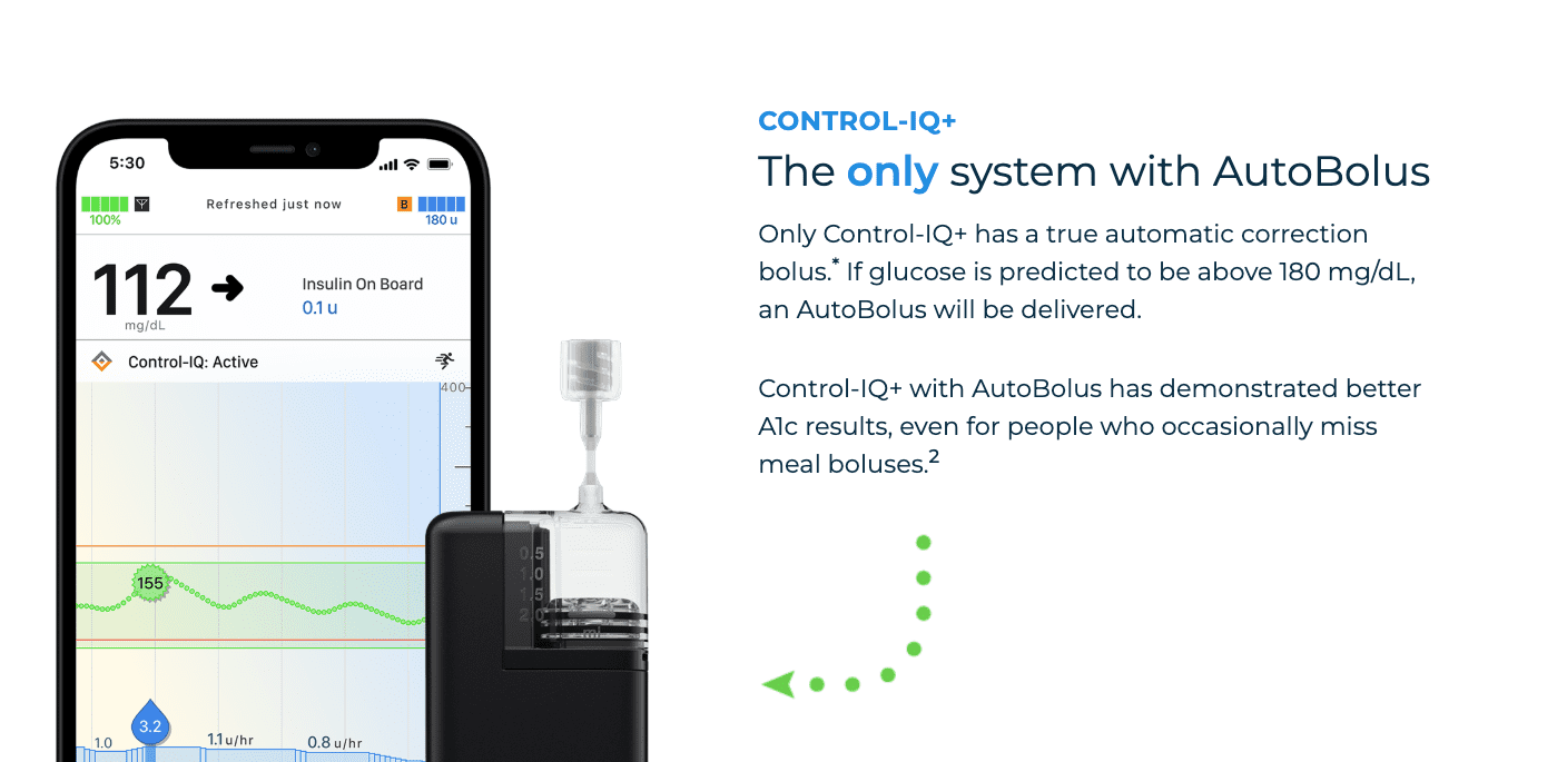 Automated Insulin Delivery: Tandem Diabetes Unveils Control-IQ+ Enhancements