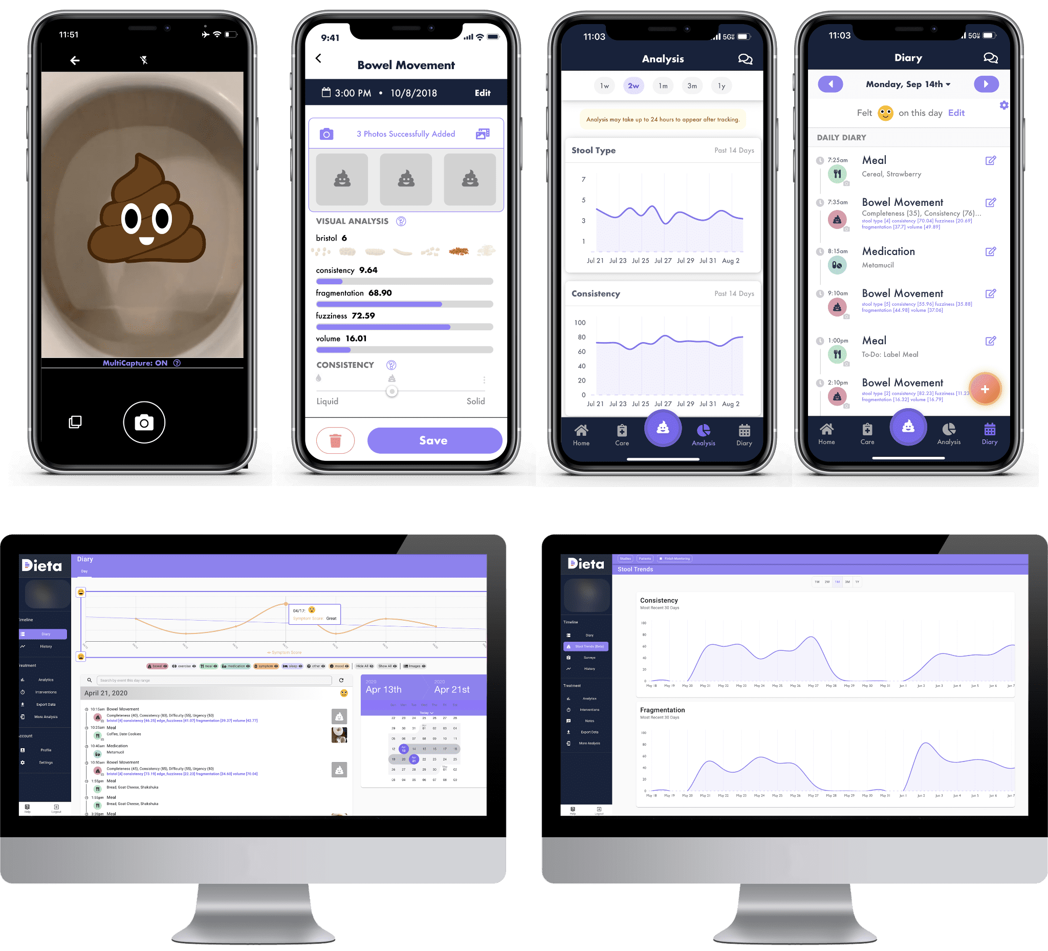 Cylinder Acquires AI-powered Stool Imaging Platform Dieta Health