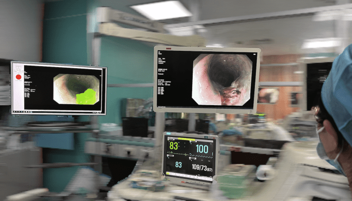 Effect of computer aided detection system on esophageal neoplasm diagnosis in varied levels of endoscopists