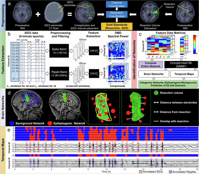 Machine learning on interictal intracranial EEG predicts surgical outcome in drug resistant epilepsy