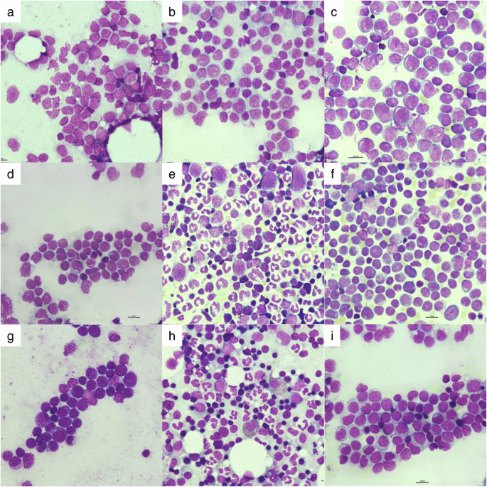 Synthetic bone marrow images augment real samples in developing acute myeloid leukemia microscopy classification models
