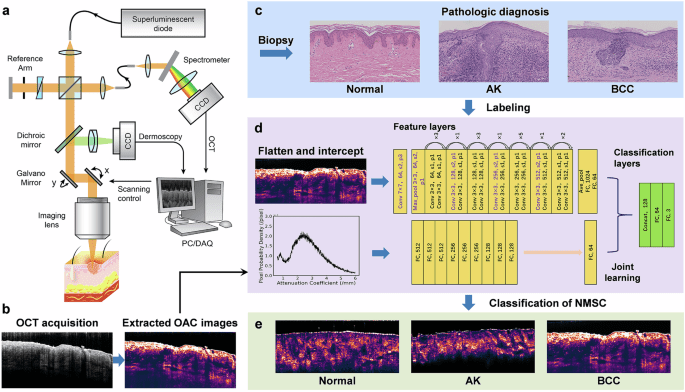 A joint learning approach for automated diagnosis of keratinocyte carcinoma using optical attenuation coefficients