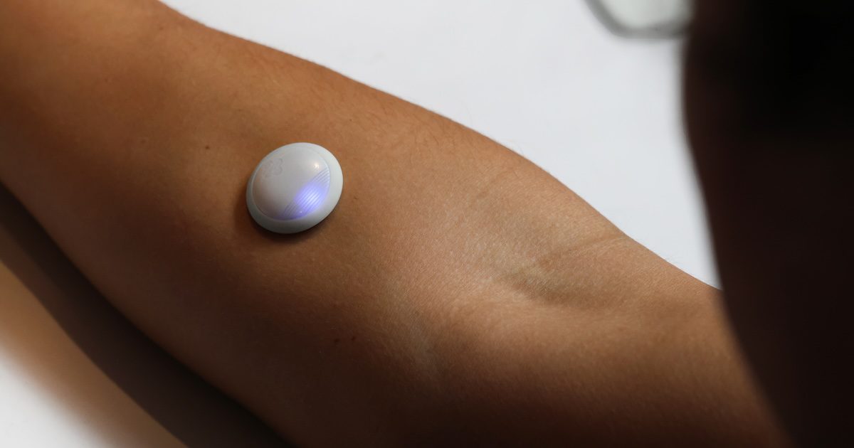 Biolinq raises $100M for intradermal glucose sensor for type 2 diabetes
