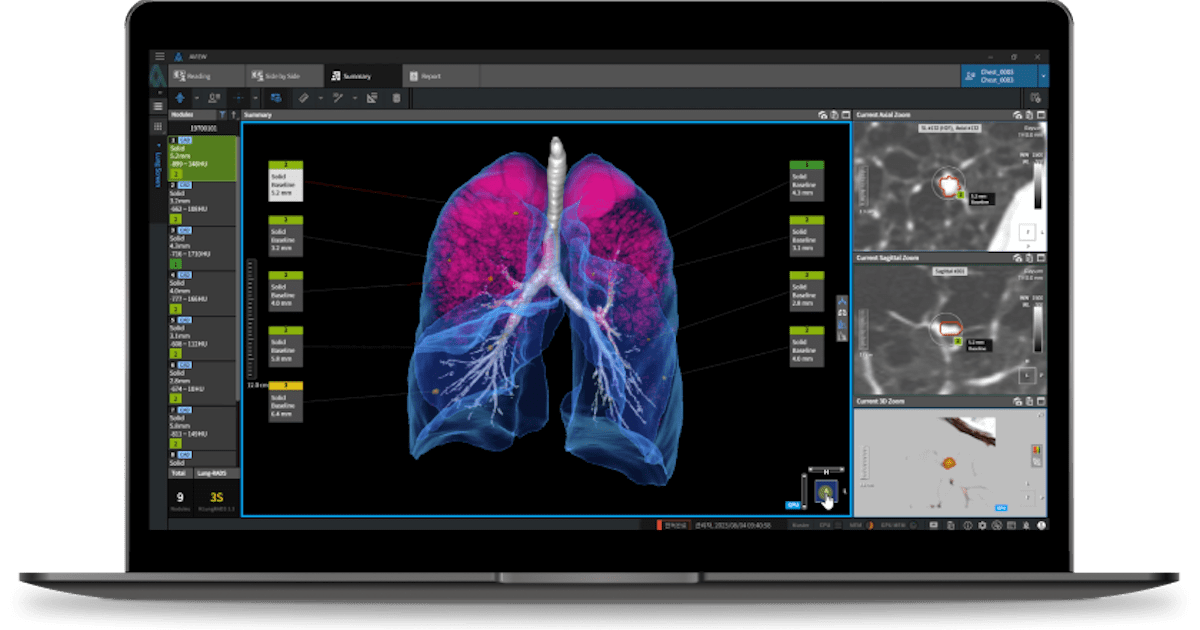 Coreline Soft enters China and more briefs