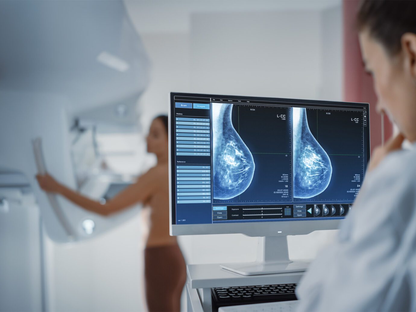 iCAD to Integrate AI Breast Cancer Detection into Microsoft’s Precision Imaging Network