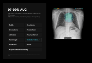 SimonMed Imaging Partners with Lunit to Deploy AI for Breast Cancer Detection