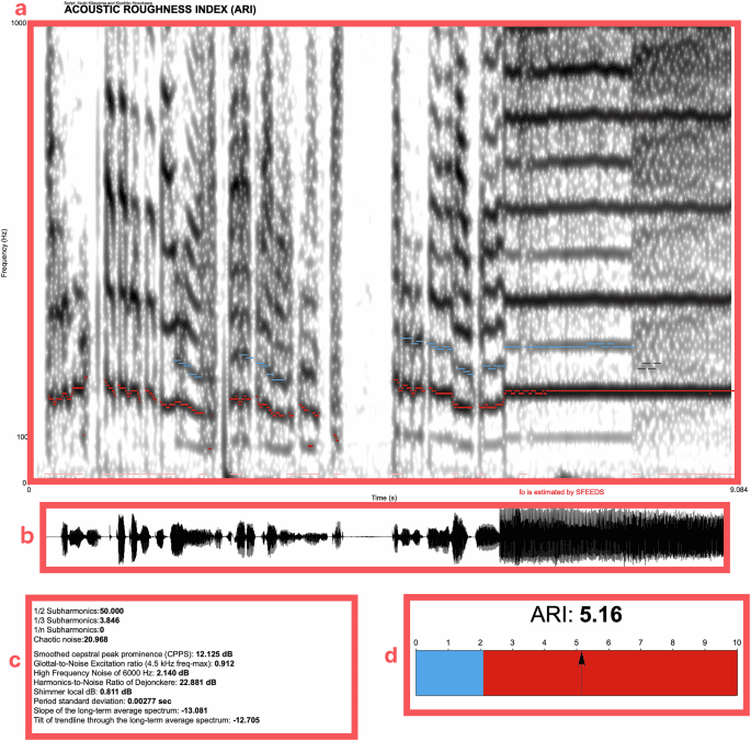 A multivariate model incorporating subharmonic measurements for evaluating vocal roughness