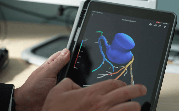 AI-driven heart scans speed up diagnosis and save millions