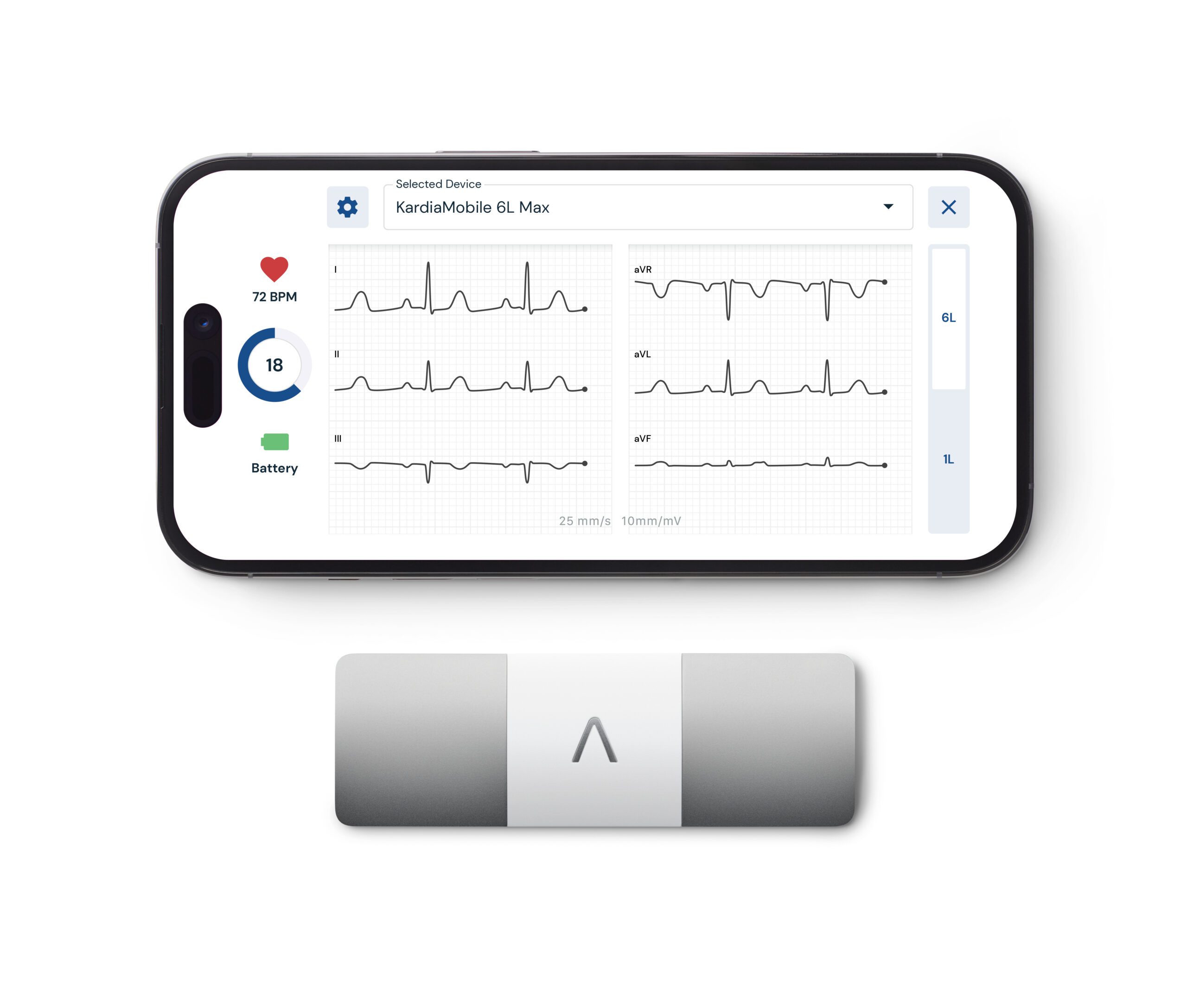 ​​AliveCor Unveils KardiaMobile 6L Max &nullnullnullnullnullnullnullnullnullnull