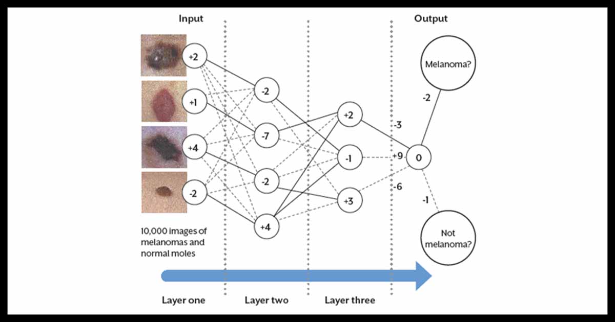 Artificial neural networks date back to the 1950s – now they are ready to transform healthcare